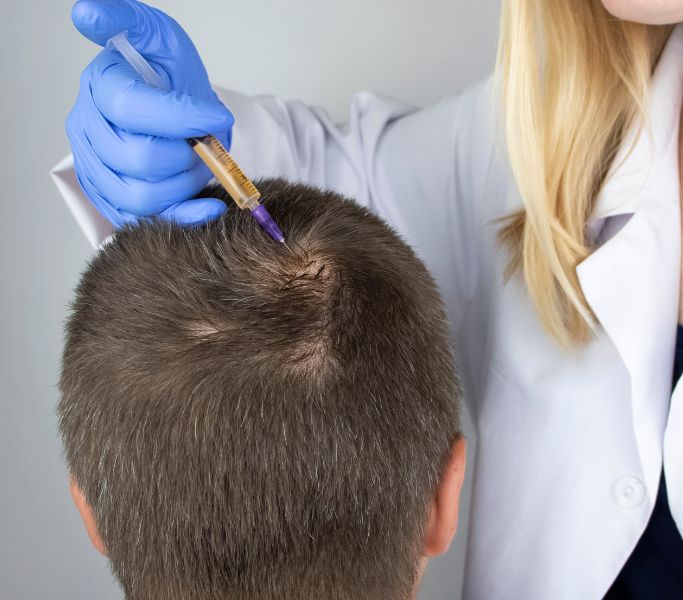 Alopecias inflamatorias