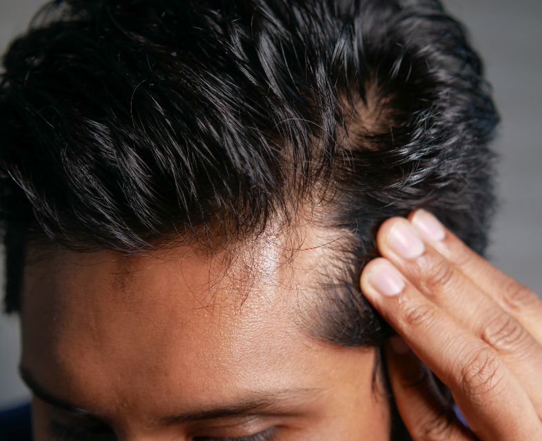 Dermatología capilar en Sevilla