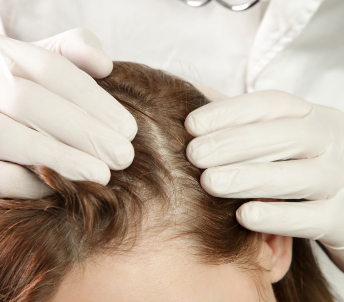Dermatología capilar Sevilla