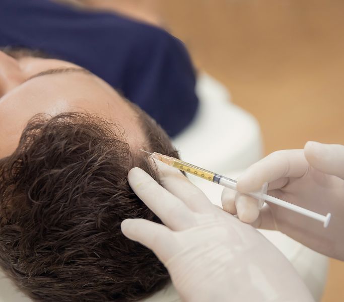 Tipos de caída del pelo