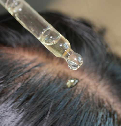 dermatología capilar