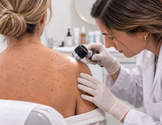 Seguimiento después de un cáncer de piel