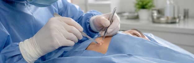Tratamiento del cáncer de piel en Sevilla extirpación quirúrgica